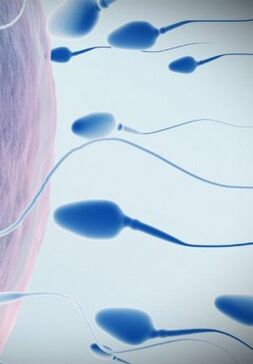 Spermogramm bei geringer Potenz